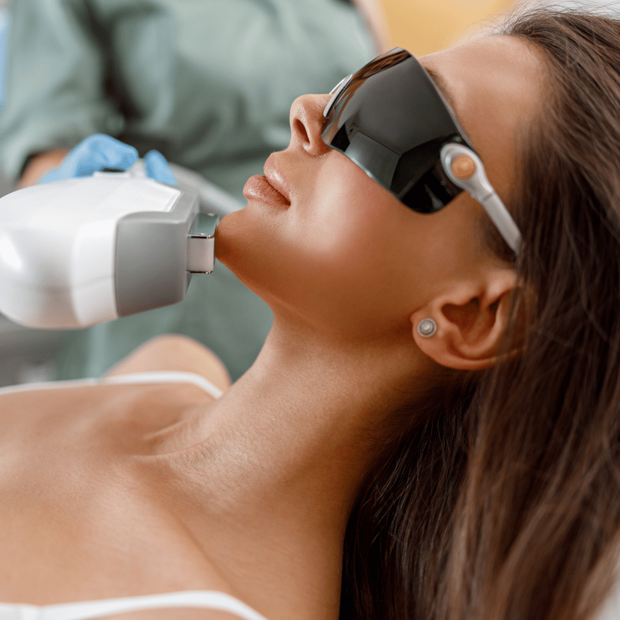 IPL Photofacial
